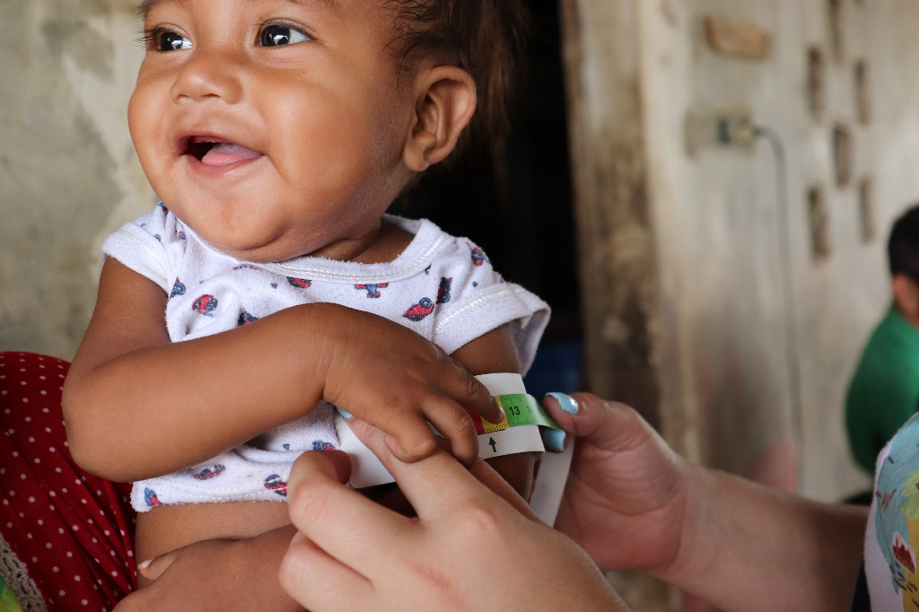 niño en su evaluación nutricional